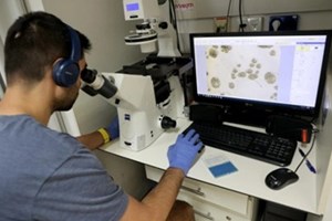 ນັກຄົ້ນຄວ້າອິສຣາແອນ ຄົ້ນພົບກົນໄກຂອງສະໝອງ ທີ່ຄວບຄຸມອາການເຈັບປວດ